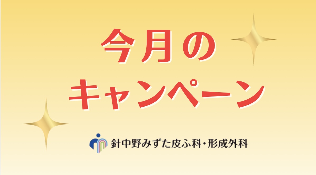 今月のキャンペーン