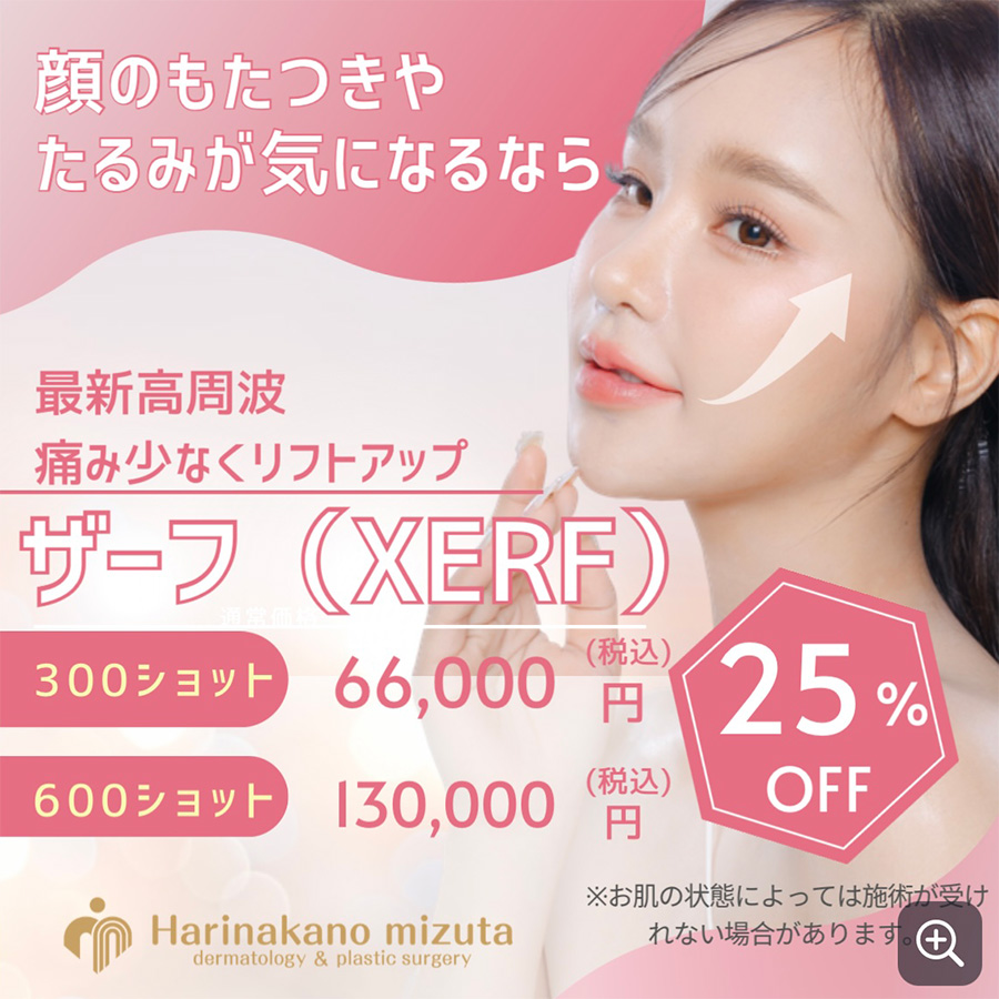 今月のキャンペーン