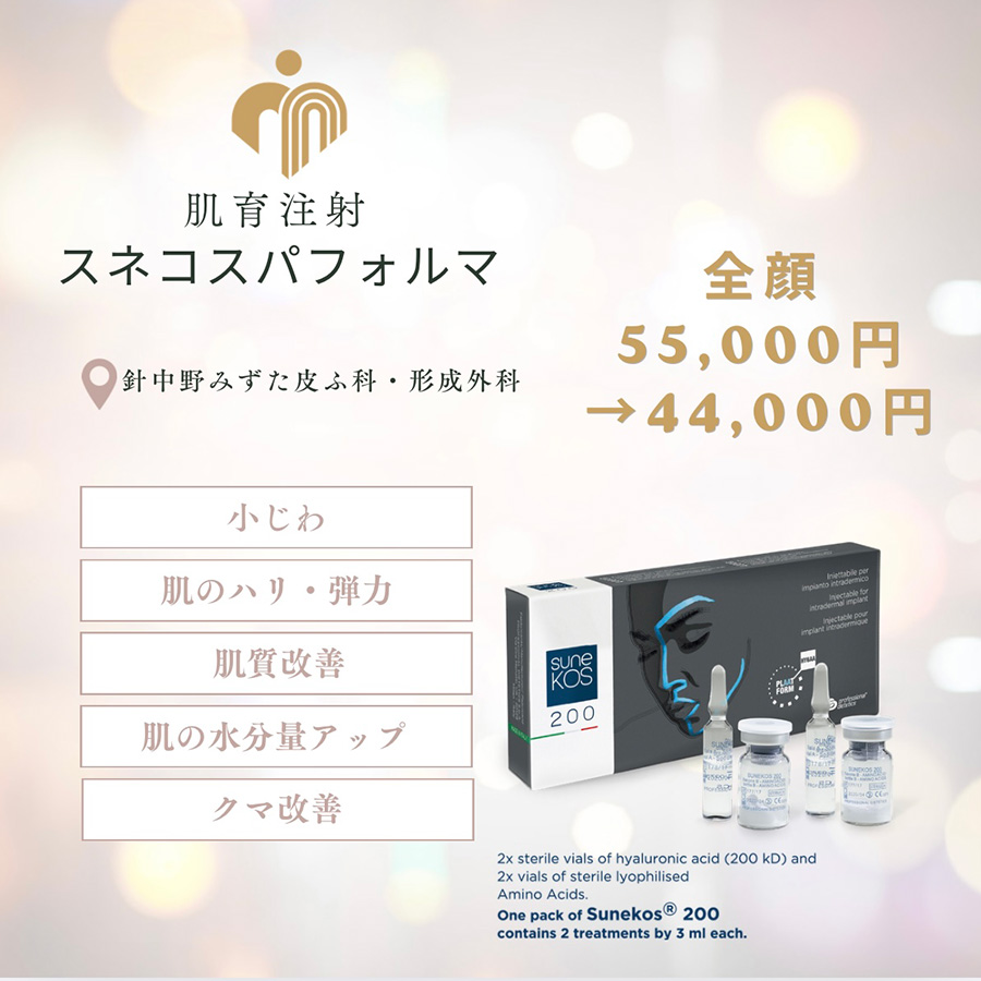 今月のキャンペーン