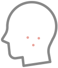 ほくろ