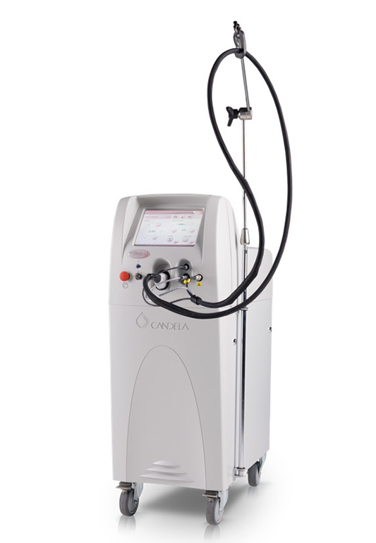 Vビーム（Vbeam）とは