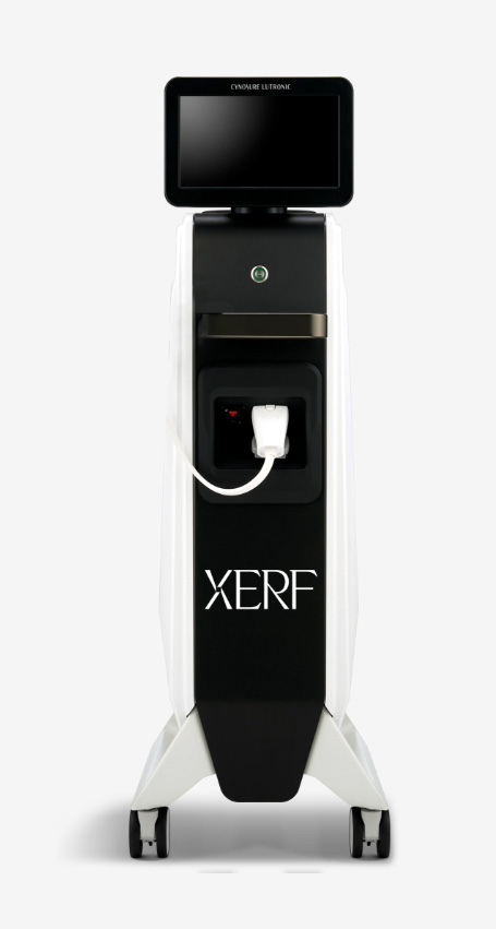 XERF（ザーフ）とは
